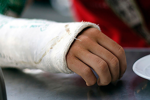 На витебских врачей завели уголовное дело за ампутацию руки подростку